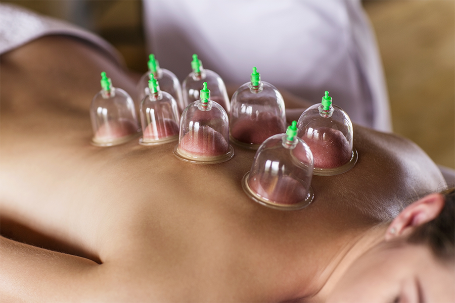 Full Body Cupping Massage: A Journey to Complete Relaxation and Healing
